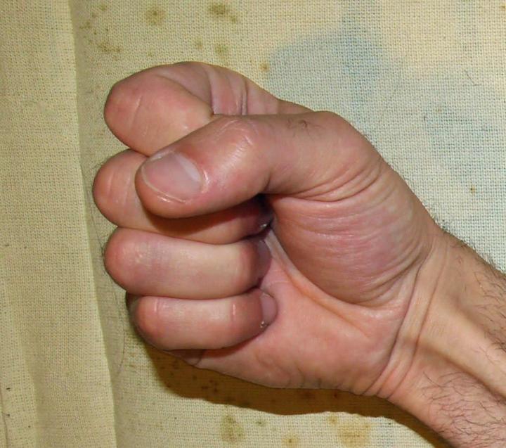 A Guide To Reversing Masturbation Death Grip Syndrome