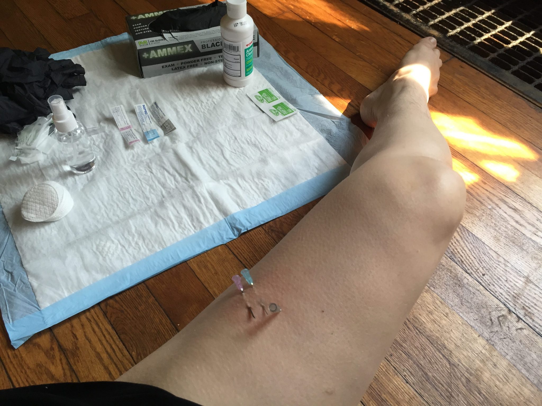 Needle Play Tips And Tricks